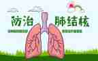 2022年结核工作计划6篇