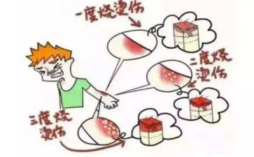 小心烧烫伤教案7篇
